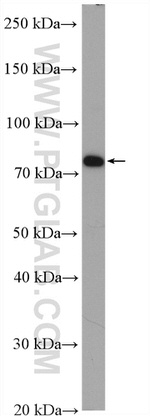 PADI2 Antibody in Western Blot (WB)
