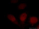 DPF2 Antibody in Immunocytochemistry (ICC/IF)