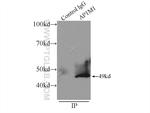 AP1M1 Antibody in Immunoprecipitation (IP)
