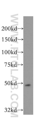 AP1M1 Antibody in Western Blot (WB)