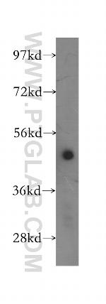 AP1M1 Antibody in Western Blot (WB)