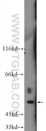 AP1M1 Antibody in Western Blot (WB)