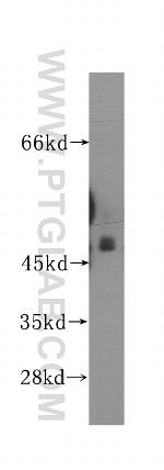 AP3M1 Antibody in Western Blot (WB)