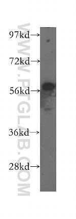 MCCC2 Antibody in Western Blot (WB)
