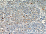 LRDD Antibody in Immunohistochemistry (Paraffin) (IHC (P))