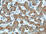 LRDD Antibody in Immunohistochemistry (Paraffin) (IHC (P))