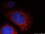 LRDD Antibody in Immunocytochemistry (ICC/IF)