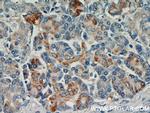 LRDD Antibody in Immunohistochemistry (Paraffin) (IHC (P))