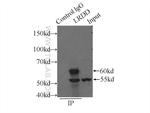 LRDD Antibody in Immunoprecipitation (IP)