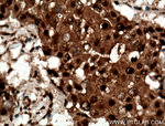 RAD23B Antibody in Immunohistochemistry (Paraffin) (IHC (P))