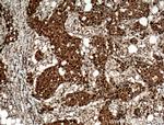 RAD23B Antibody in Immunohistochemistry (Paraffin) (IHC (P))