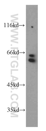 RAD23B Antibody in Western Blot (WB)