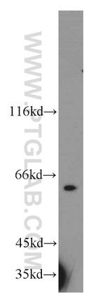 RAD23B Antibody in Western Blot (WB)