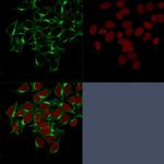 Clathrin, Heavy Chain Monoclonal Antibody (CHC, 1432)
