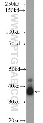 CREM Antibody in Western Blot (WB)