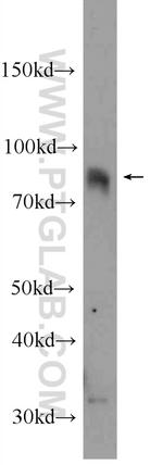 CIN85 Antibody in Western Blot (WB)