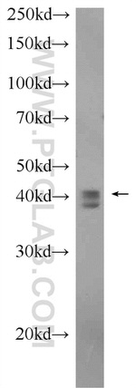 TIA1 Antibody in Western Blot (WB)