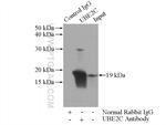 UBE2C Antibody in Immunoprecipitation (IP)