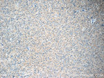 NCKAP1 Antibody in Immunohistochemistry (Paraffin) (IHC (P))