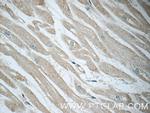 NCKAP1 Antibody in Immunohistochemistry (Paraffin) (IHC (P))