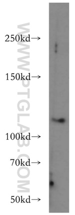 NCKAP1 Antibody in Western Blot (WB)