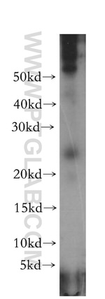 OIP5 Antibody in Western Blot (WB)