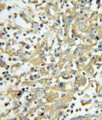 PRKCSH Antibody in Immunohistochemistry (Paraffin) (IHC (P))