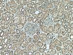 PRKCSH Antibody in Immunohistochemistry (Paraffin) (IHC (P))