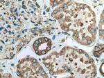 PRKCSH Antibody in Immunohistochemistry (Paraffin) (IHC (P))