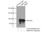 PRKCSH Antibody in Immunoprecipitation (IP)