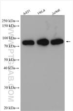 PRKCSH Antibody in Western Blot (WB)