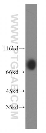 PRKCSH Antibody in Western Blot (WB)