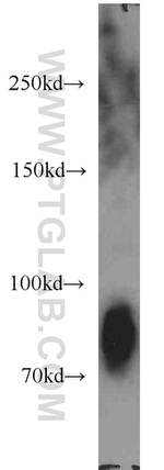 PRKCSH Antibody in Western Blot (WB)