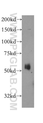 ATL1 Antibody in Western Blot (WB)
