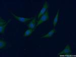 CCBL1/KAT1 Antibody in Immunocytochemistry (ICC/IF)