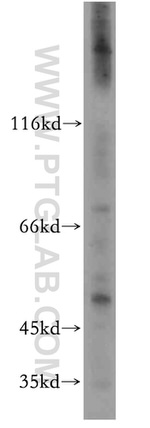 CCBL1/KAT1 Antibody in Western Blot (WB)