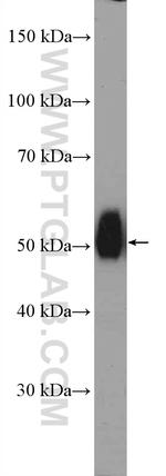 CCBL1/KAT1 Antibody in Western Blot (WB)