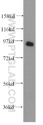 GPRASP2 Antibody in Western Blot (WB)