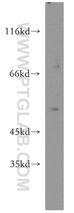 PAR2 Antibody in Western Blot (WB)