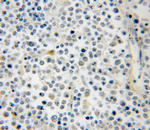 RAB39B Antibody in Immunohistochemistry (Paraffin) (IHC (P))