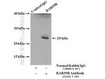 RAB39B Antibody in Immunoprecipitation (IP)