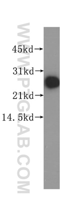 RAB39B Antibody in Western Blot (WB)