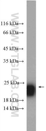 RAB39B Antibody in Western Blot (WB)