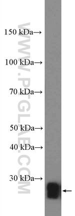 RAB39B Antibody in Western Blot (WB)