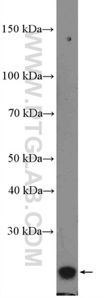 RAB39B Antibody in Western Blot (WB)