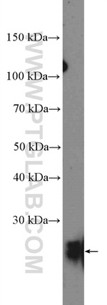 RAB39B Antibody in Western Blot (WB)