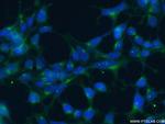 GOPC Antibody in Immunocytochemistry (ICC/IF)