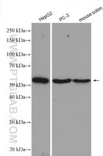 GOPC Antibody in Western Blot (WB)