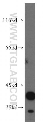 CANT1 Antibody in Western Blot (WB)