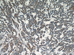Dysadherin Antibody in Immunohistochemistry (Paraffin) (IHC (P))